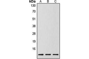 Western blot analysis of Caspase 14 p10 expression in MCF7 (A), mouse spleen (B), rat liver (C) whole cell lysates. (Caspase 14 p10 抗体  (Center))