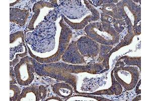 IHC analysis of SIRT5 using anti-SIRT5 antibody (ABIN7602524).