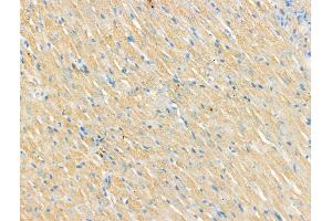 ABIN7094509 and ABIN7098558 at 1/100 staining Rat heart tissue by IHC-P. (CNGA2 抗体  (C-Term))