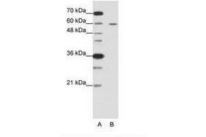 Image no. 2 for anti-Frizzled Family Receptor 5 (FZD5) (C-Term) antibody (ABIN6736225) (FZD5 抗体  (C-Term))