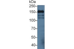 Western blot analysis of Mouse Cerebrum lysate, using Mouse ICAM5 Antibody (3 µg/ml) and HRP-conjugated Goat Anti-Rabbit antibody ( (ICAM5 抗体  (AA 164-441))