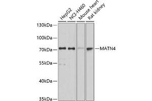 Western blot analysis of extracts of various cell lines, using M antibody (ABIN3016623, ABIN3016624, ABIN1680779 and ABIN6219802) at 1:3000 dilution. (MATN4 抗体  (AA 221-540))