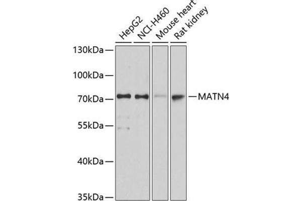 MATN4 抗体  (AA 221-540)