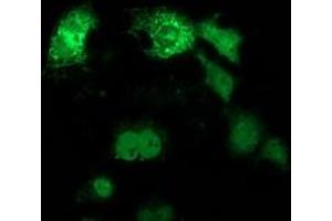 Immunofluorescence (IF) image for anti-Ankyrin Repeat Domain 53 (ANKRD53) (AA 1-300) antibody (ABIN1490721) (ANKRD53 抗体  (AA 1-300))