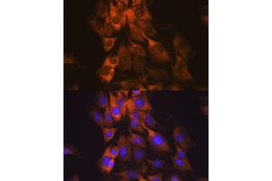 Immunofluorescence analysis of C6 cells using MEK1 antibody (ABIN7268633). (MEK1 抗体)