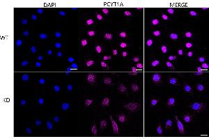 Immunocytochemical staining of HeLa cells using PCYT1A antibody (ABIN7799789), 1:1,000), Top panel: wild-type (WT), Bottom panal: PCYT1A shRNA knockdown (KD). (Recombinant PCYT1A 抗体)