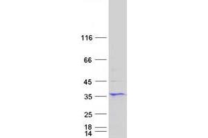 Western Blotting (WB) image for Six Transmembrane Epithelial Antigen of The Prostate 1 (STEAP1) protein (Myc-DYKDDDDK Tag) (ABIN2732839)
