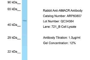 Western Blotting (WB) image for anti-alpha-Methylacyl-CoA Racemase (AMACR) (Middle Region) antibody (ABIN2788590) (AMACR 抗体  (Middle Region))