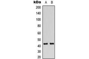 Western blot analysis of Connexin 43 (pS368) expression in Jurkat (A), A549 (B) whole cell lysates. (Connexin 43/GJA1 抗体  (C-Term, pSer368))