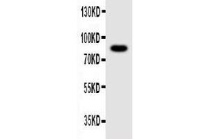 Anti-NLRP4G antibody, Western blotting WB: Mouse Ovary Tissue Lysate (NLRP4G 抗体  (C-Term))