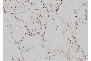 ABIN6269358 at 1/100 staining Human lung tissue by IHC-P. (IRF3 抗体  (C-Term))