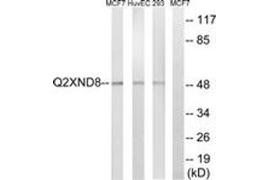 Western Blotting (WB) image for anti-Cytochrome P450, Family 2, Subfamily D, Polypeptide 6 (CYP2D6) (AA 41-90) antibody (ABIN2890723) (CYP2D6 抗体  (AA 41-90))