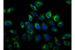 Immunofluorescence staining of A549 cells with ABIN7153831 at 1:66, counter-stained with DAPI. (GSG1-Like 抗体  (AA 84-176))