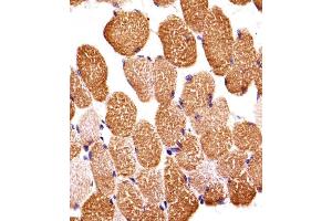 Immunohistochemical analysis of paraffin-embedded H. (SIRPB1 抗体  (N-Term))