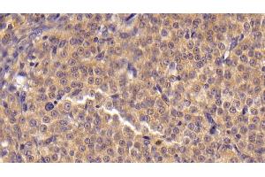 Immunohistochemistry (IHC) image for anti-Angiopoietin-Like 4 (ANGPTL4) (AA 182-388) antibody (ABIN7433018)