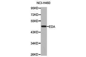 Western Blotting (WB) image for anti-Ectodysplasin A (EDA) antibody (ABIN1872415) (Ectodysplasin A 抗体)