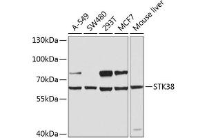 Western blot analysis of extracts of various cell lines, using STK38 antibody (ABIN6132692, ABIN6148616, ABIN6148617 and ABIN6224215) at 1:1000 dilution.