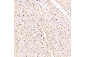 Immunohistochemistry analysis of paraffin-embedded rat heart using,Myoz2 (ABIN7074744) at dilution of 1: 6000 (MYOZ2 抗体)