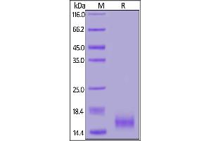 SDS-PAGE (SDS) image for CD59 (CD59) (AA 26-102) protein (His tag) (ABIN7013413)