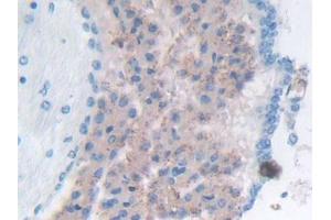 Detection of GaA in Mouse Cerebrum Tissue using Polyclonal Antibody to Glucosidase Alpha, Acid (GaA) (GAA 抗体  (AA 755-953))
