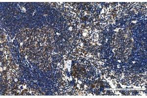 IHC analysis of TFEB using anti-TFEB antibody (ABIN7599321).