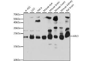 Western blot analysis of extracts of various cell lines, using  antibody (ABIN7265493) at 1:1000 dilution. (ARL3 抗体  (AA 1-182))