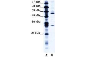Western Blotting (WB) image for anti-Coronin, Actin Binding Protein, 1A (CORO1A) (C-Term) antibody (ABIN2775701)