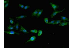 Immunofluorescent analysis of Hela cells using ABIN7158215 at dilution of 1:100 and Alexa Fluor 488-congugated AffiniPure Goat Anti-Rabbit IgG(H+L) (LSMEM1 抗体  (AA 1-131))