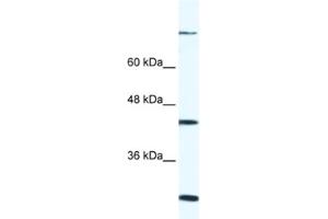 Western Blotting (WB) image for anti-FYVE, RhoGEF and PH Domain Containing 1 (FGD1) antibody (ABIN2460269) (FGD1 抗体)