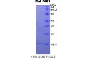 SDS-PAGE of Protein Standard from the Kit (Highly purified E. (SLIT1 ELISA 试剂盒)