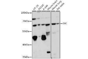 Western blot analysis of extracts of various cell lines, using SRC antibody. (Src 抗体  (AA 410-536))