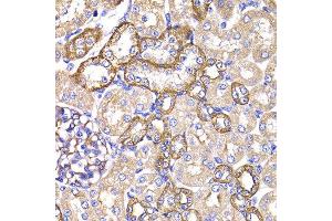 Immunohistochemistry of paraffin-embedded rat kidney using PPL antibody at dilution of 1:100 (x400 lens). (PPL 抗体)
