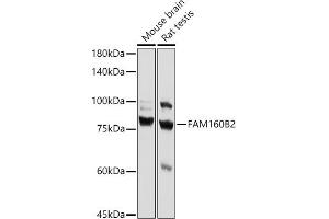Western blot analysis of extracts of various cell lines, using FB2 antibody (ABIN7267112) at 1:1000 dilution. (FAM160B2 抗体)