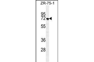 SUSD5 Antibody (C-term) (ABIN655447 and ABIN2844977) western blot analysis in ZR-75-1 cell line lysates (35 μg/lane). (SUSD5 抗体  (C-Term))