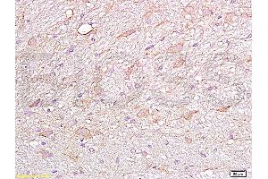 Formalin-fixed and paraffin embedded rat brain labeled Anti-FGFR4 Polyclonal Antibody, Unconjugated (ABIN671766) at 1:200, followed by conjugation to the secondary antibody and DAB staining (FGFR4 抗体  (AA 1-100))