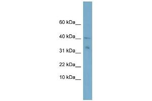 WB Suggested Anti-NDUFV3 Antibody Titration:  0. (NDUFV3 抗体  (Middle Region))