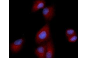 Immunofluorescence (IF) image for anti-Dipeptidyl-Peptidase 4 (DPP4) (AA 39-766) antibody (APC) (ABIN5566982) (DPP4 抗体  (AA 39-766) (APC))