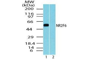 Image no. 1 for anti-Nuclear Receptor Subfamily 2, Group F, Member 6 (NR2F6) (AA 20-70) antibody (ABIN960291) (NR2F6 抗体  (AA 20-70))