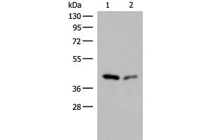 Western blot analysis of Hela and HEPG2 cell lysates using GIPC1 Polyclonal Antibody at dilution of 1:400 (GIPC1 抗体)
