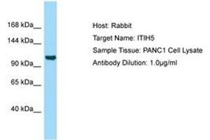 Image no. 1 for anti-Inter alpha Globulin Inhibitor H5 (ITIH5) (AA 92-141) antibody (ABIN6750011) (ITIH5 抗体  (AA 92-141))