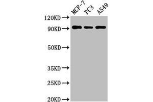 Western Blot Positive WB detected in: MCF-7 whole cell lysate, PC-3 whole cell lysate, A549 whole cell lysate All lanes: AMPD1 antibody at 3 μg/mL Secondary Goat polyclonal to rabbit IgG at 1/50000 dilution Predicted band size: 91, 90 kDa Observed band size: 91 kDa