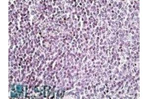 AP22454PU-N AIM2 antibody staining of paraffin embedded Human Spleen at 3. (AIM2 抗体  (C-Term))
