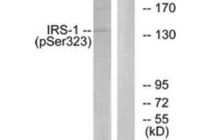 Western blot analysis of extracts from COS7 cells treated with Serum 20% 15', using IRS-1 (Phospho-Ser323) Antibody. (IRS1 抗体  (pSer323))