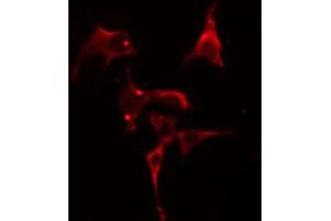 ABIN6274809 staining Hela cells by IF/ICC. (LPCAT2 抗体  (N-Term))