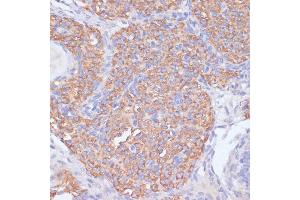 Immunohistochemistry of paraffin-embedded rat ovary using PI3 Kinase p85 beta antibody (ABIN7269320) at dilution of 1:200 (40x lens). (PIK3R2 抗体)