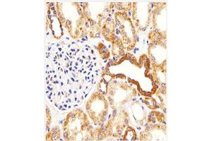 Immunohistochemical analysis of paraffin-embedded H. (BIM 抗体  (Middle Region))