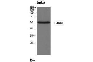 Western Blotting (WB) image for anti-Sedoheptulokinase (SHPK) (N-Term) antibody (ABIN3174167) (SHPK 抗体  (N-Term))