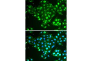 Immunofluorescence analysis of HeLa cells using ABCA3 antibody (ABIN5974136). (ABCA3 抗体)