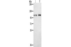 Western Blotting (WB) image for anti-Outer Dense Fiber of Sperm Tails 2 (ODF2) antibody (ABIN2828938) (ODF2 抗体)