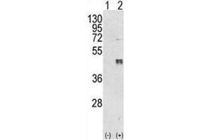 Western Blotting (WB) image for anti-CCAAT/enhancer Binding Protein (C/EBP), beta (CEBPB) (AA 271-298) antibody (ABIN3030346)